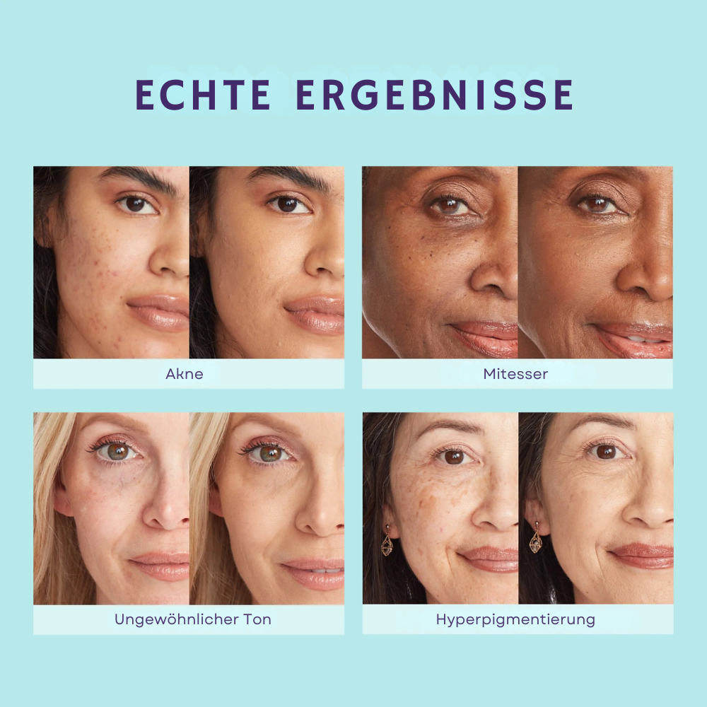 CoverCream® - Körperabdeckcreme & Unreinheiten kaschieren