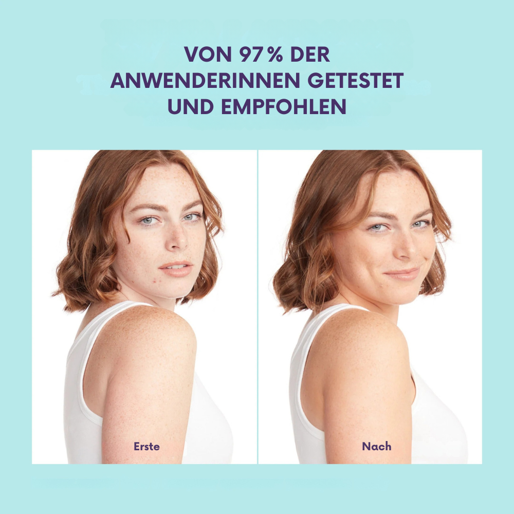 CoverCream® - Körperabdeckcreme & Unreinheiten kaschieren
