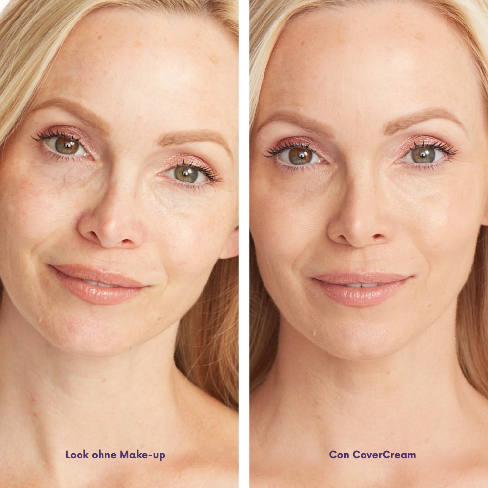 CoverCream® - Körperabdeckcreme & Unreinheiten kaschieren