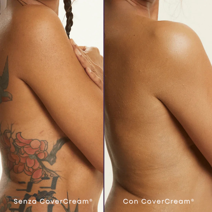 CoverCream® - Crema Copertura Corpo & Elimina Imperfezioni